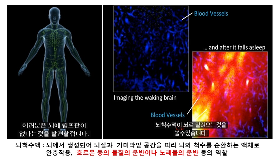 뇌척수액.jpg